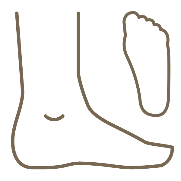 Was ist ein Senkfuß und welche Schuhe werden empfohlen?